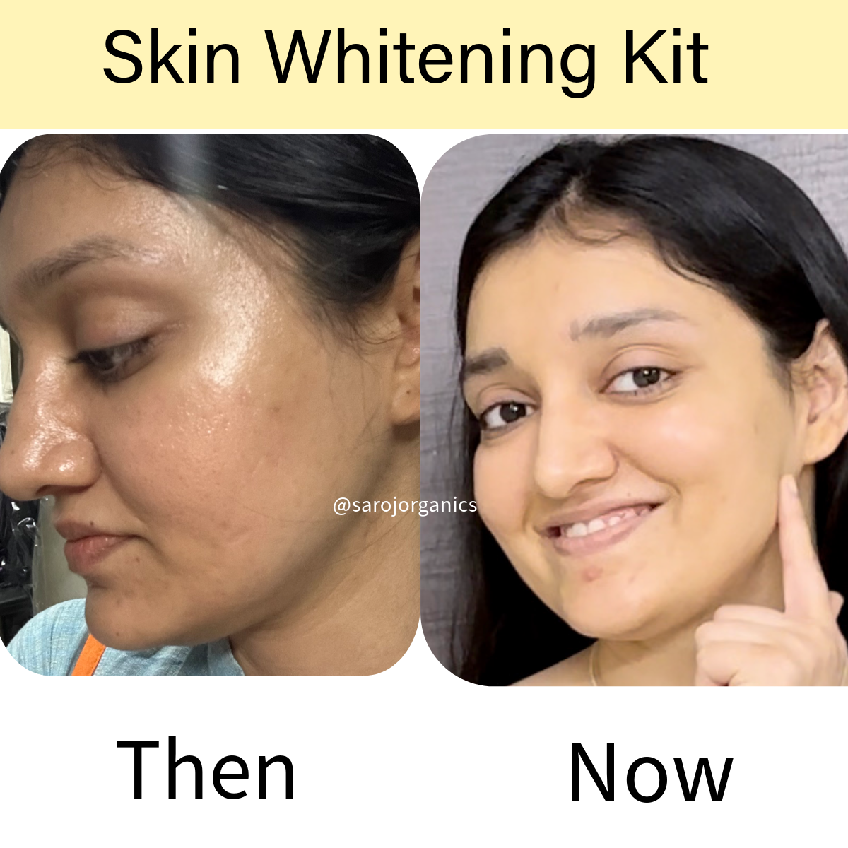 Skin Whitening KIT for skin glow, whitening, pigmentation, tanning and uneven skintone for men and women
