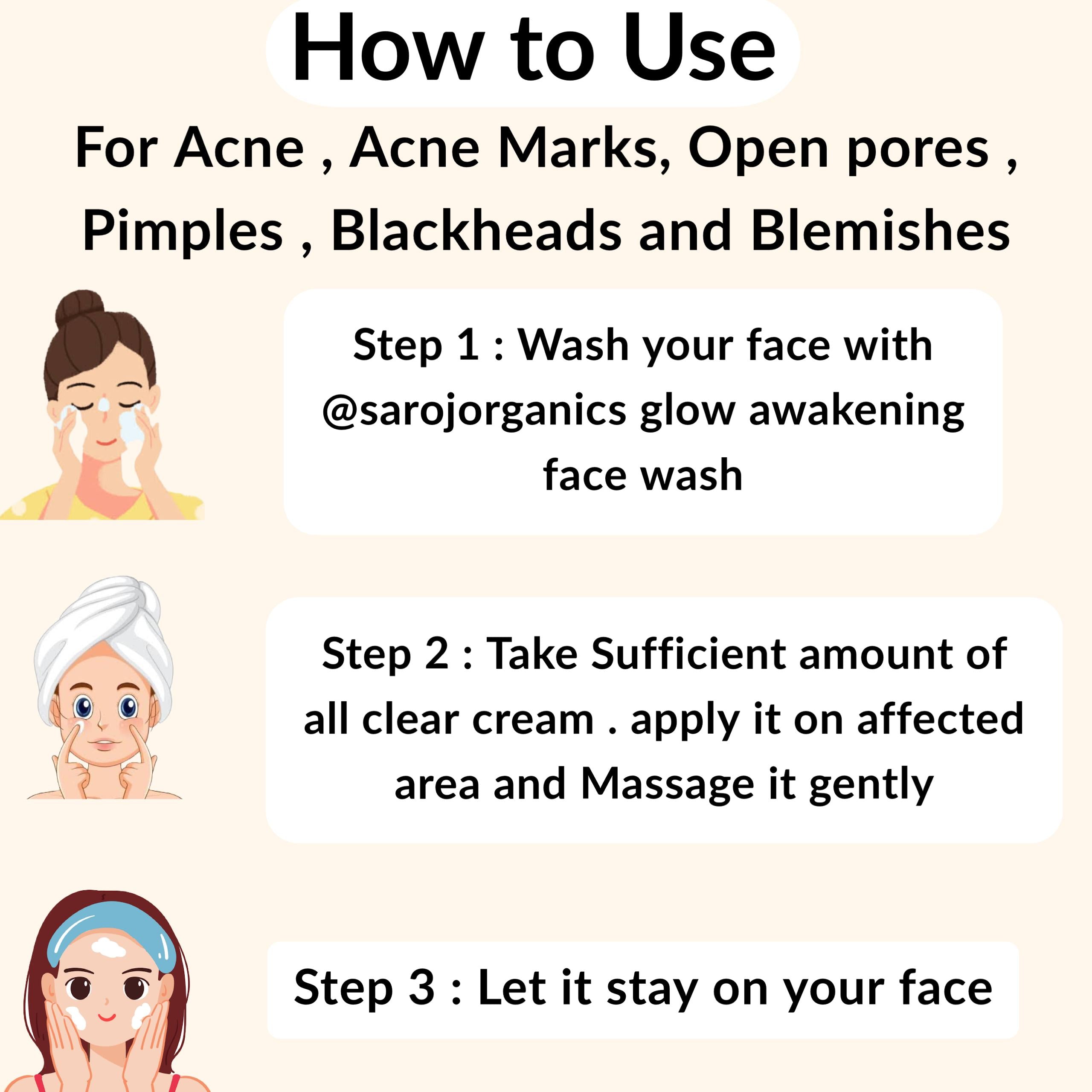 All Clear Cream, 50gm, for acne, pimples, acne marks, open pores, anti acne and blemishes - for men and women