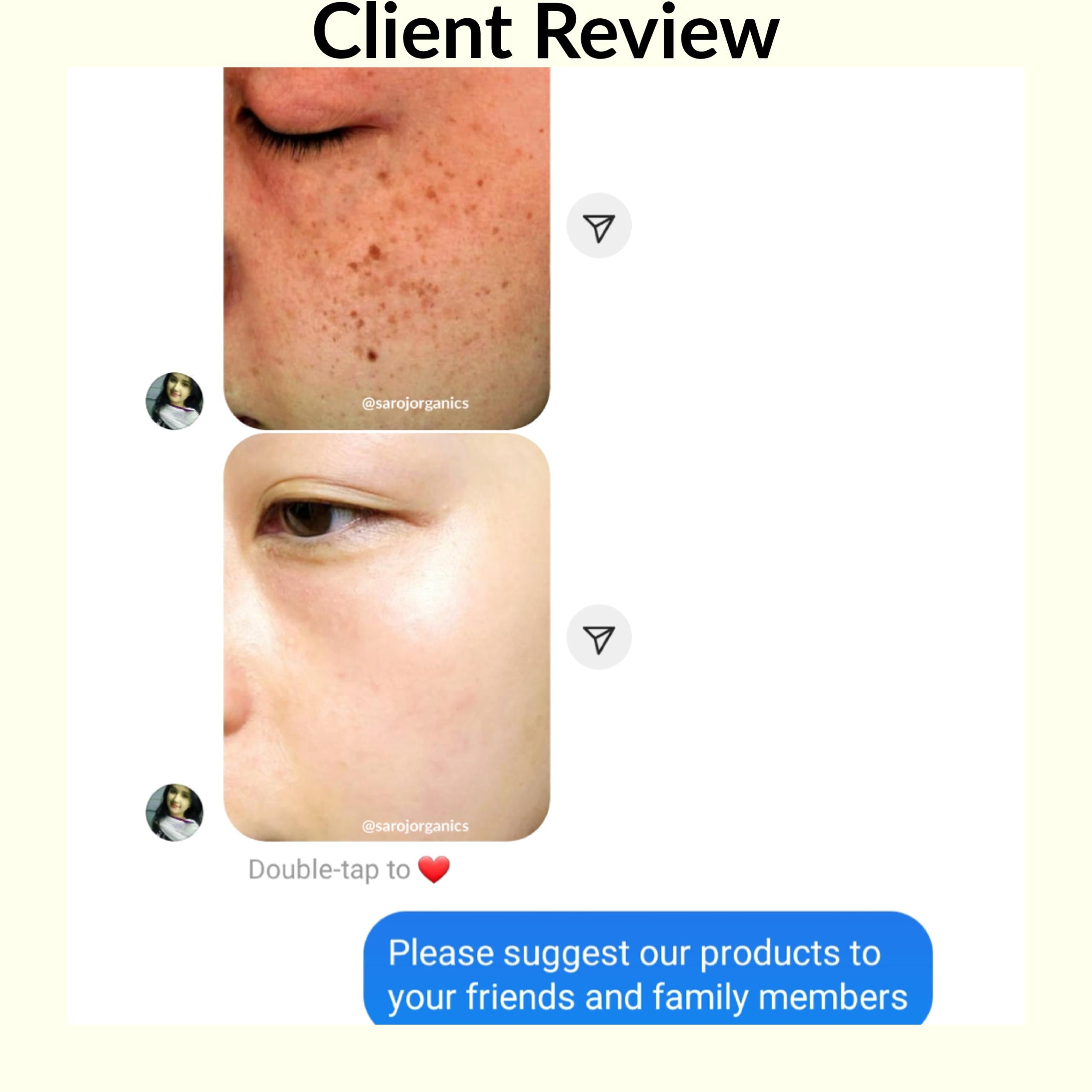 Skin Glow and whitening Cream with face wash for skin glow, whitening, pigmentation, tanning and uneven skintone - for men and women