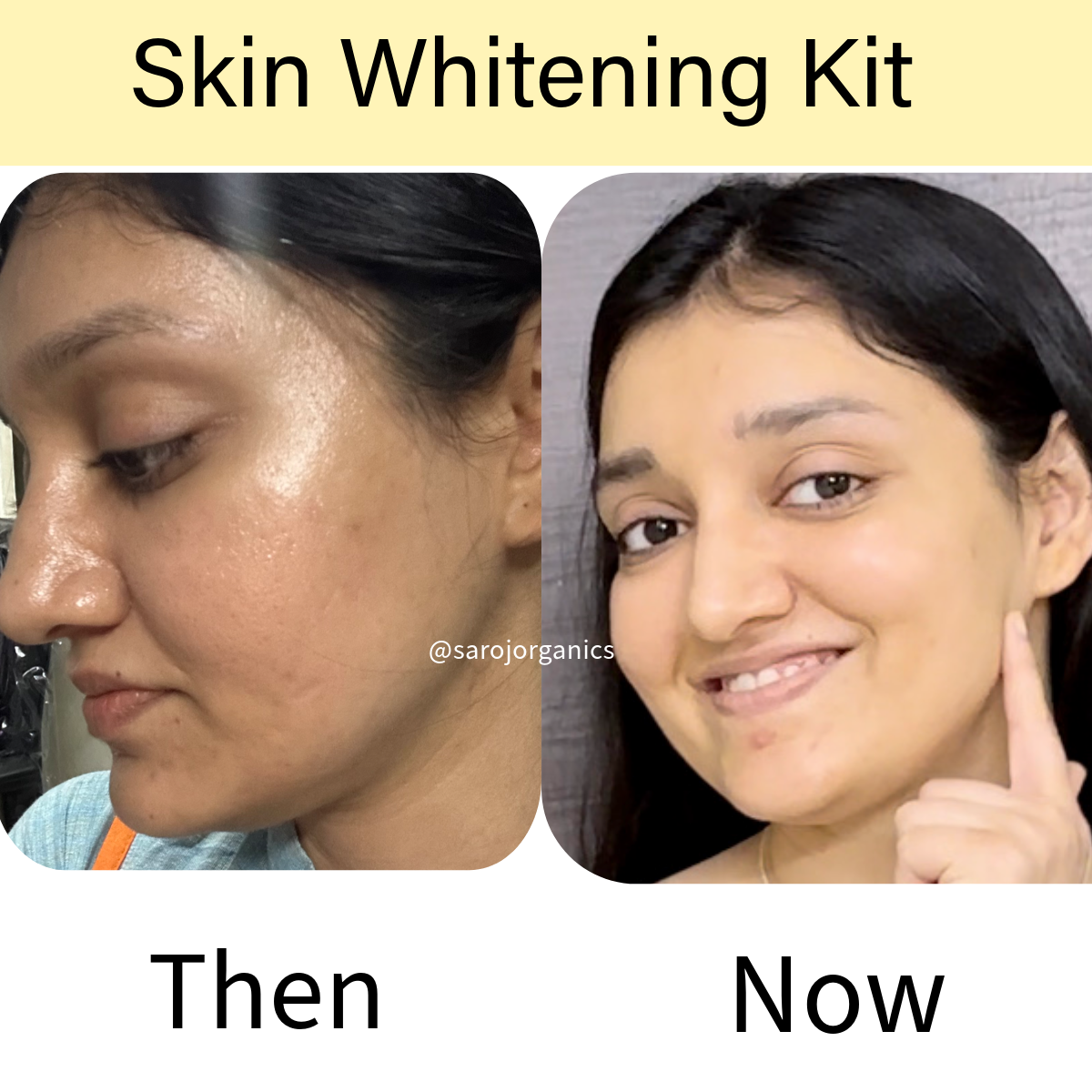 Skin Whitening KIT