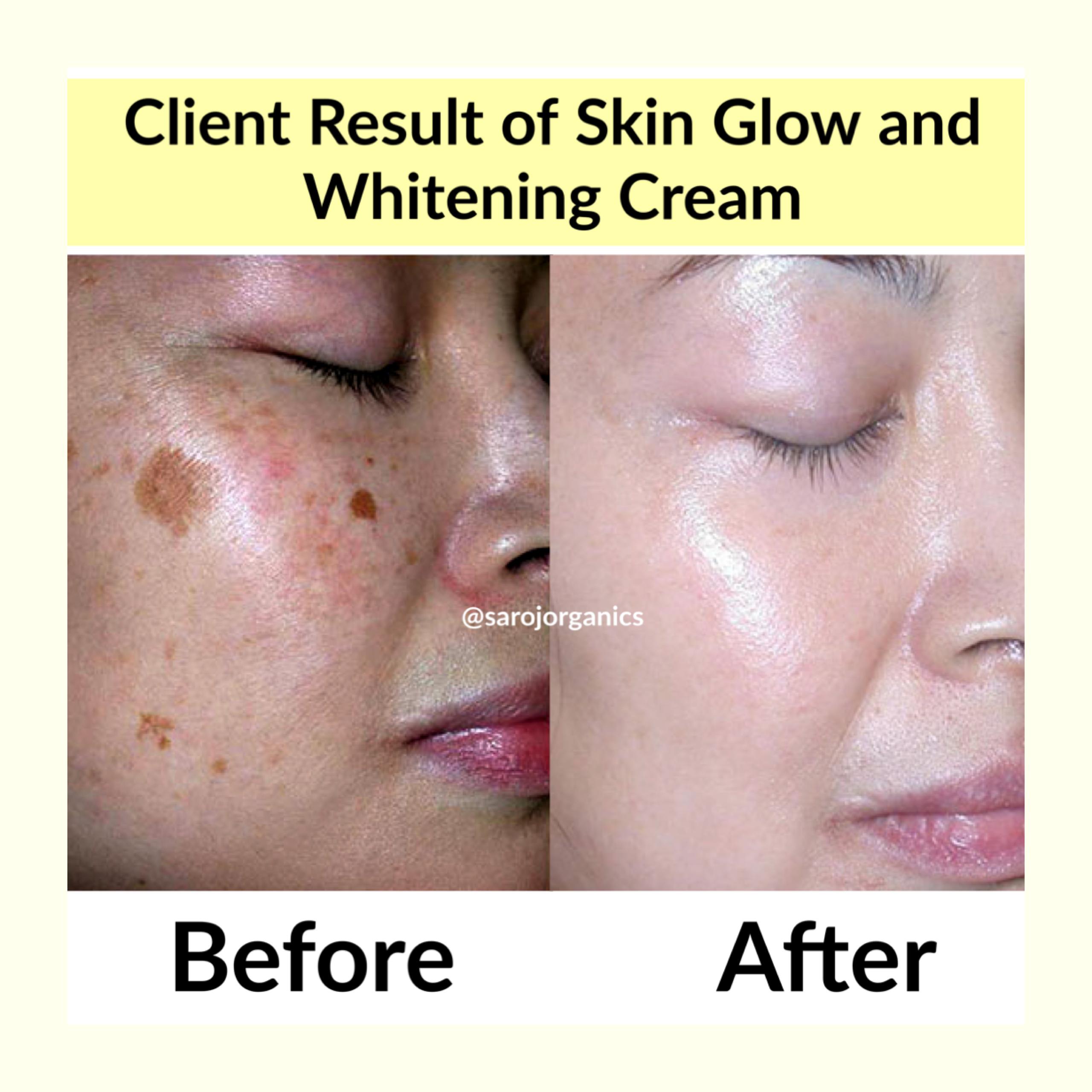 Skin Glow and whitening Cream with face wash