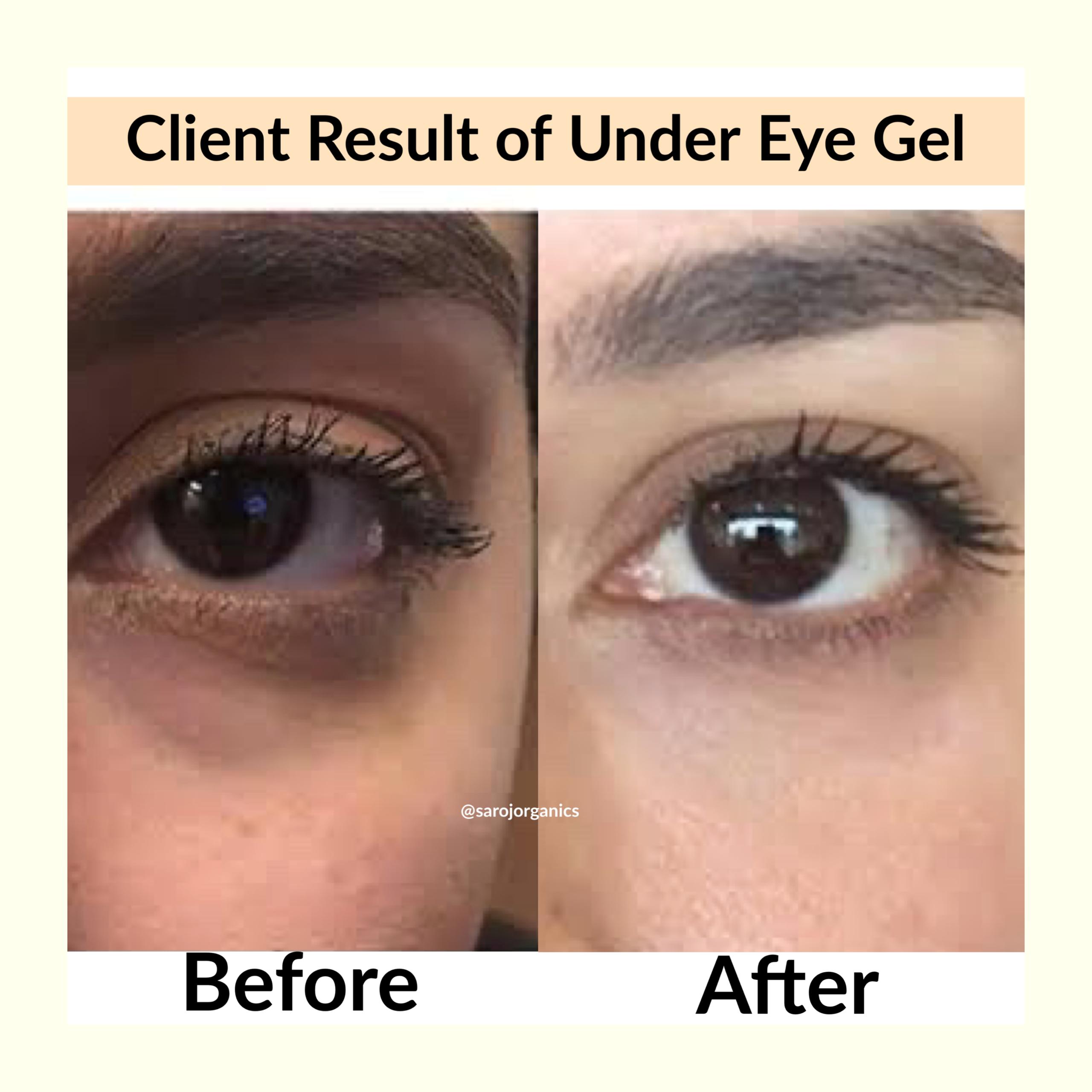 Under eye gel with face wash