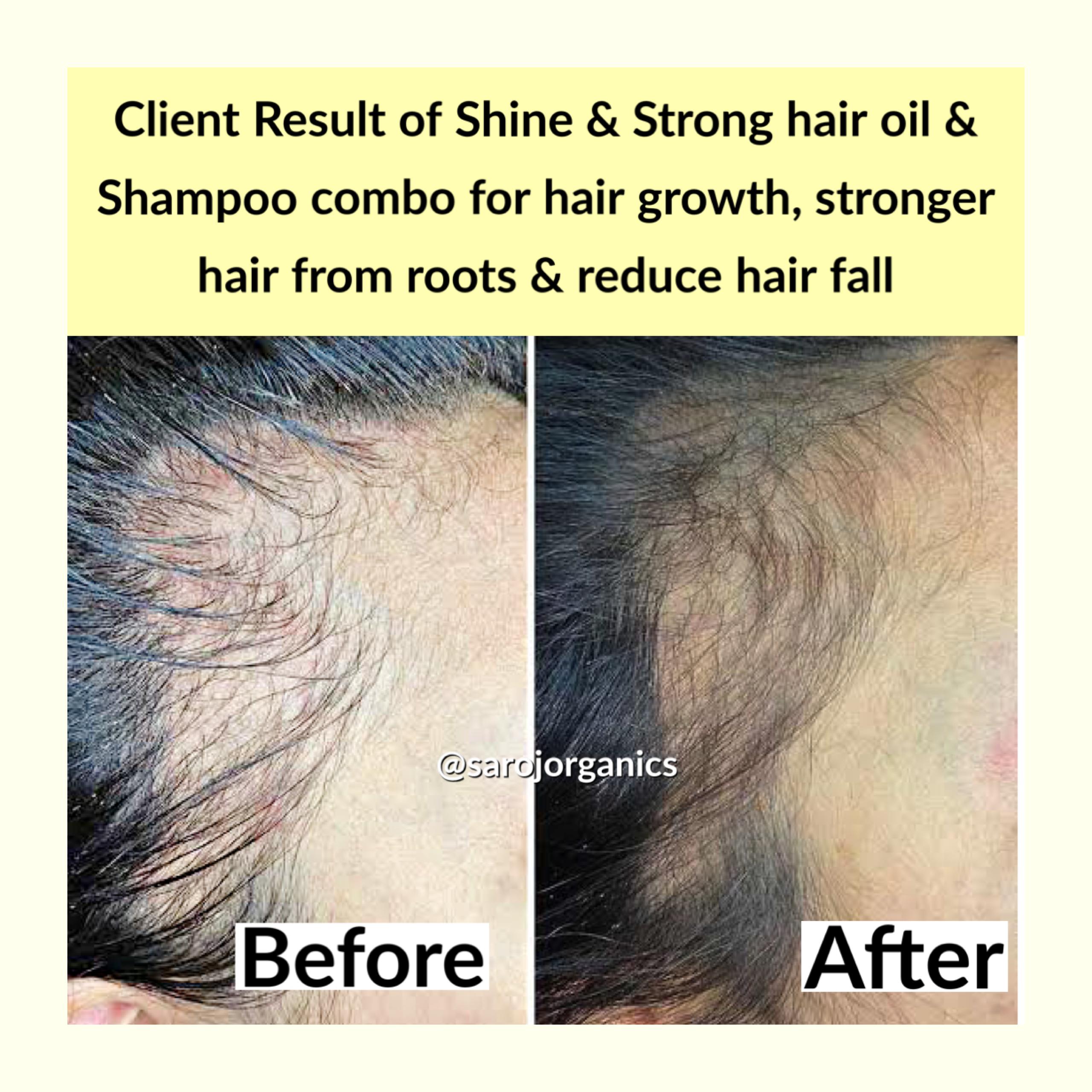 Shine and strong Hair Care KIT